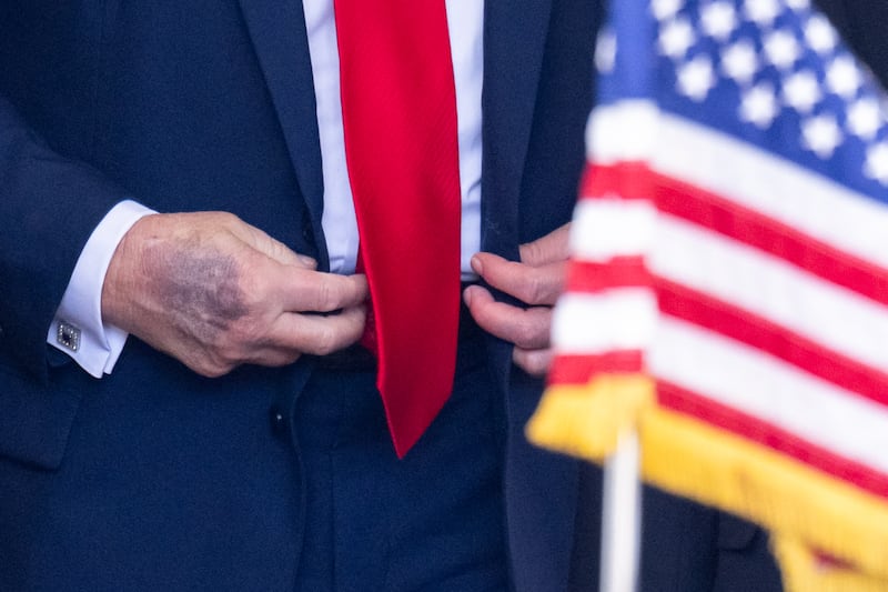 A view of the hand of US President Donald Trump as he greets South Korean President Lee Jae Myung as he arrives at the West Wing entrance of the White House in Washington, DC, on August 25, 2025. Trump on Monday suggested that a "purge or revolution" was underway in South Korea, hours before new President Lee Jae Myung was due at the White House. He did not specify to what he was referring but said he would bring it up with Lee.
